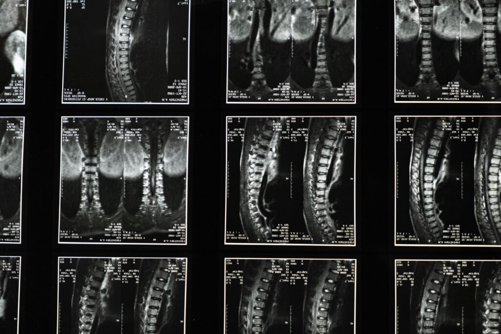 Spine, Neck And Back Injuries